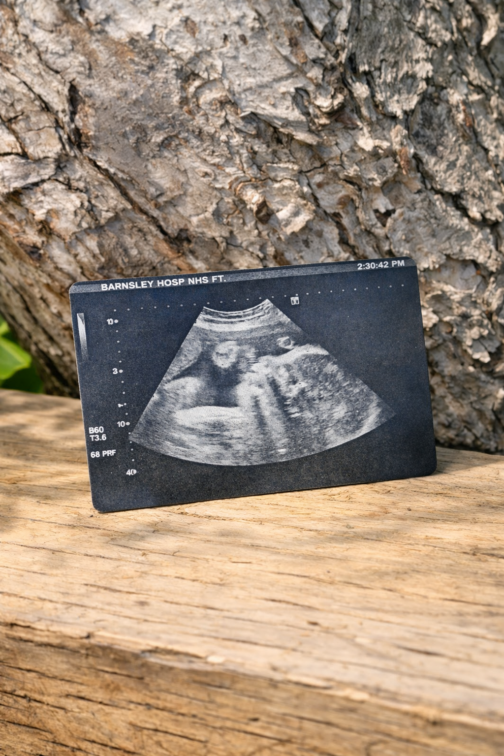 Engraved Black‑Coated Aluminium Ultrasound Wallet Card – Personalised Baby Scan Keepsake (Optional Back Message)