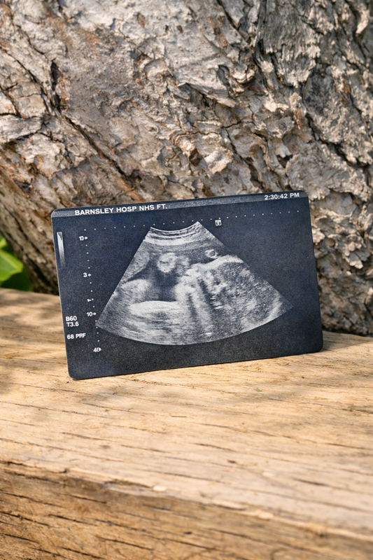 Engraved Black‑Coated Aluminium Ultrasound Wallet Card – Personalised Baby Scan Keepsake (Optional Back Message)